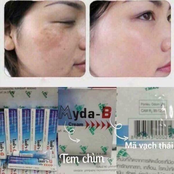 Kem Dưỡng Da mờ Nám Tàn nhang Myda b tuýp 5-15-25 gam nội địa Thái lan
